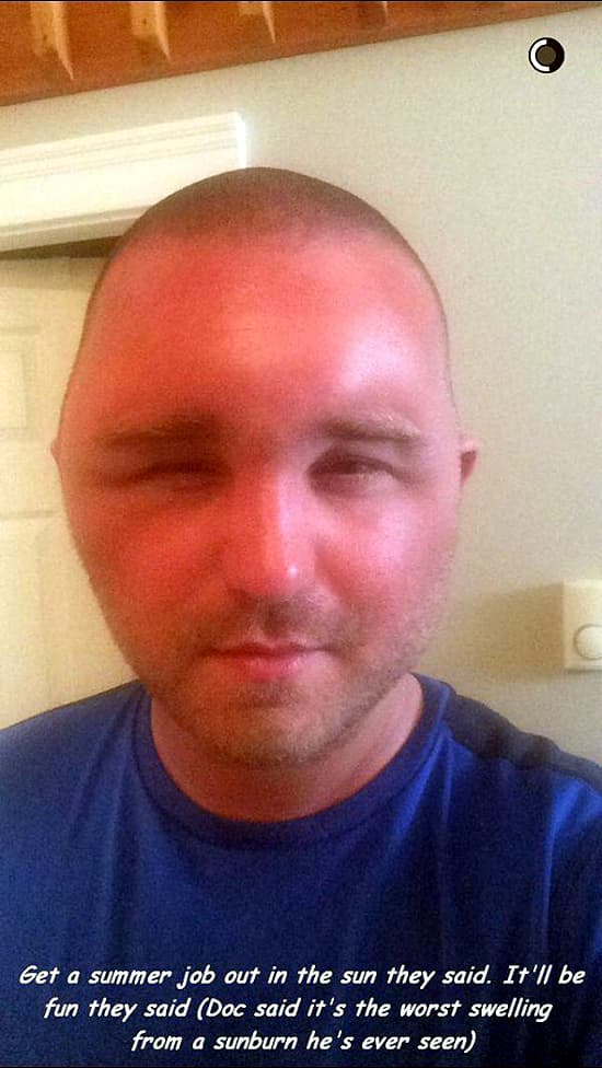 JUST WEAR A HAT. YOU'LL BE AIGHT — fail moment