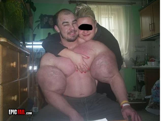 Watch: biceps Fail