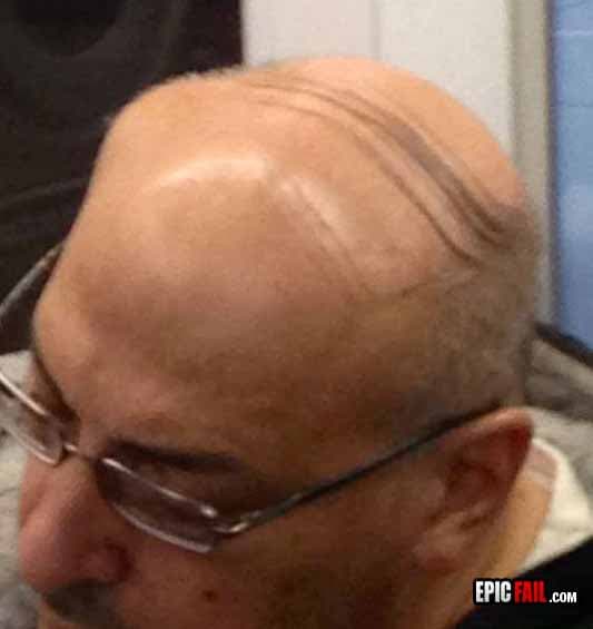 Moment: comb Over Fail