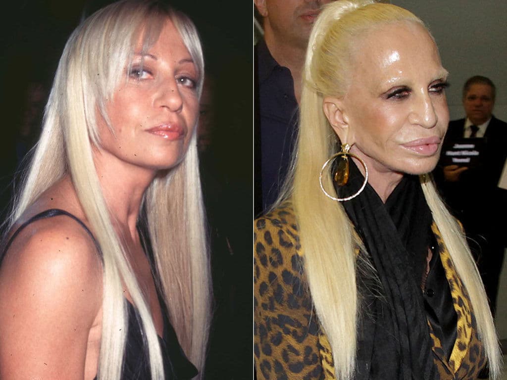 Donatella Versace: 1997 vs 2014 — fail moment