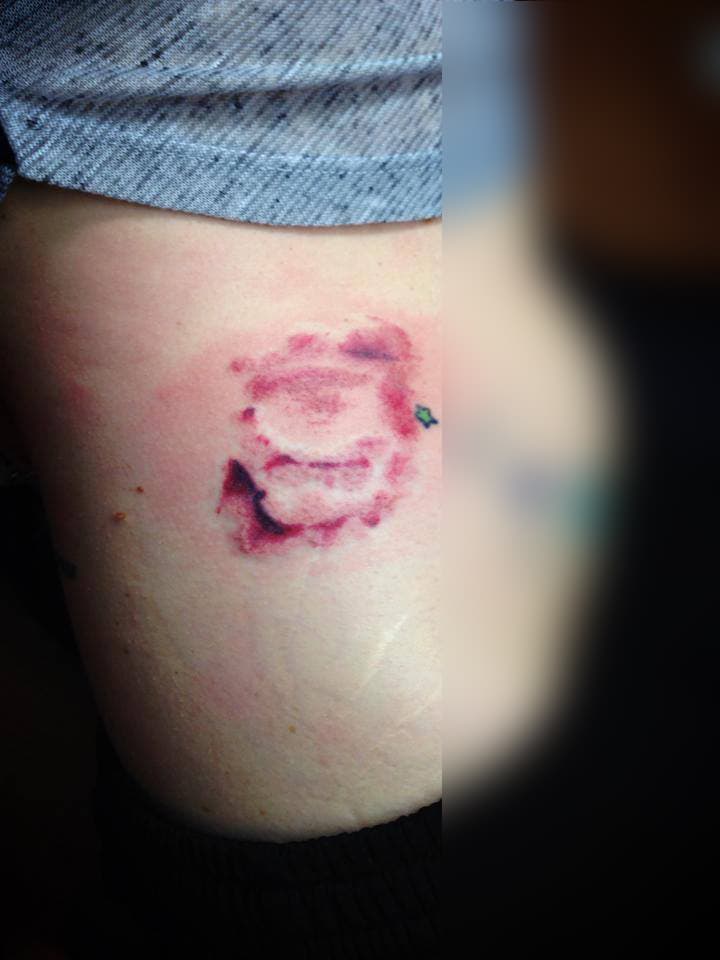 A Tattoo of Ted Bundy's Bite Mark — fail moment