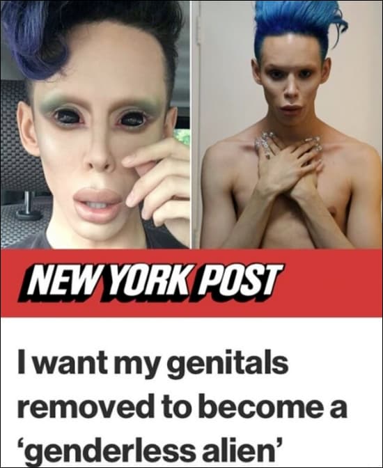 Person wants privates removed to become a genderless looking alien. — WTF moment
