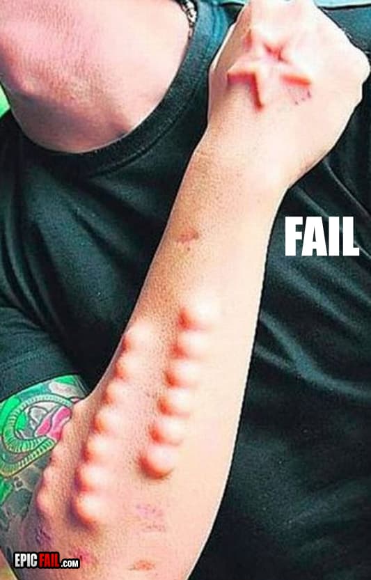 Clip: epic Body Modifications Fail