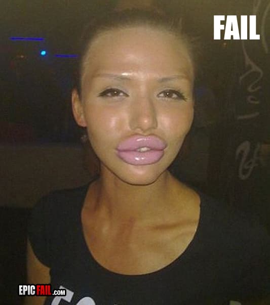 Caught on camera: beautification Fail