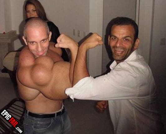 Watch: bicep Fail