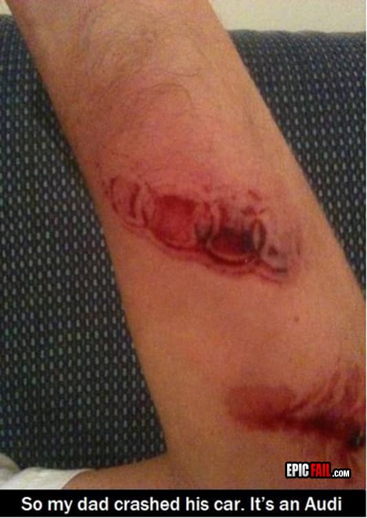 Clip: crash Wound Fail