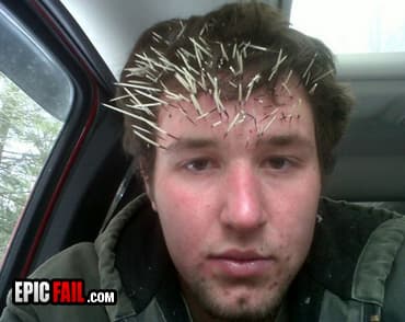 Caught on camera: wTF Porcupine FAIL