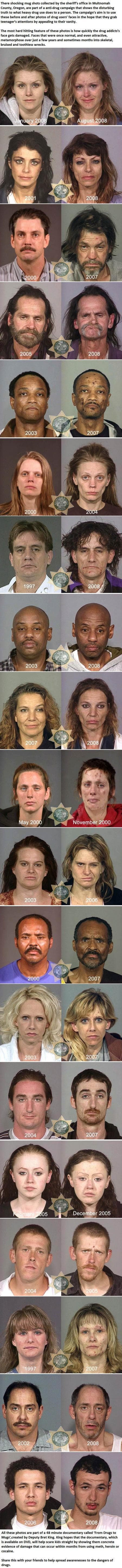 Scene: before And After Drugs FAIL – In Case There Was Ever A Doubt…. Here Are Before And After Photos.